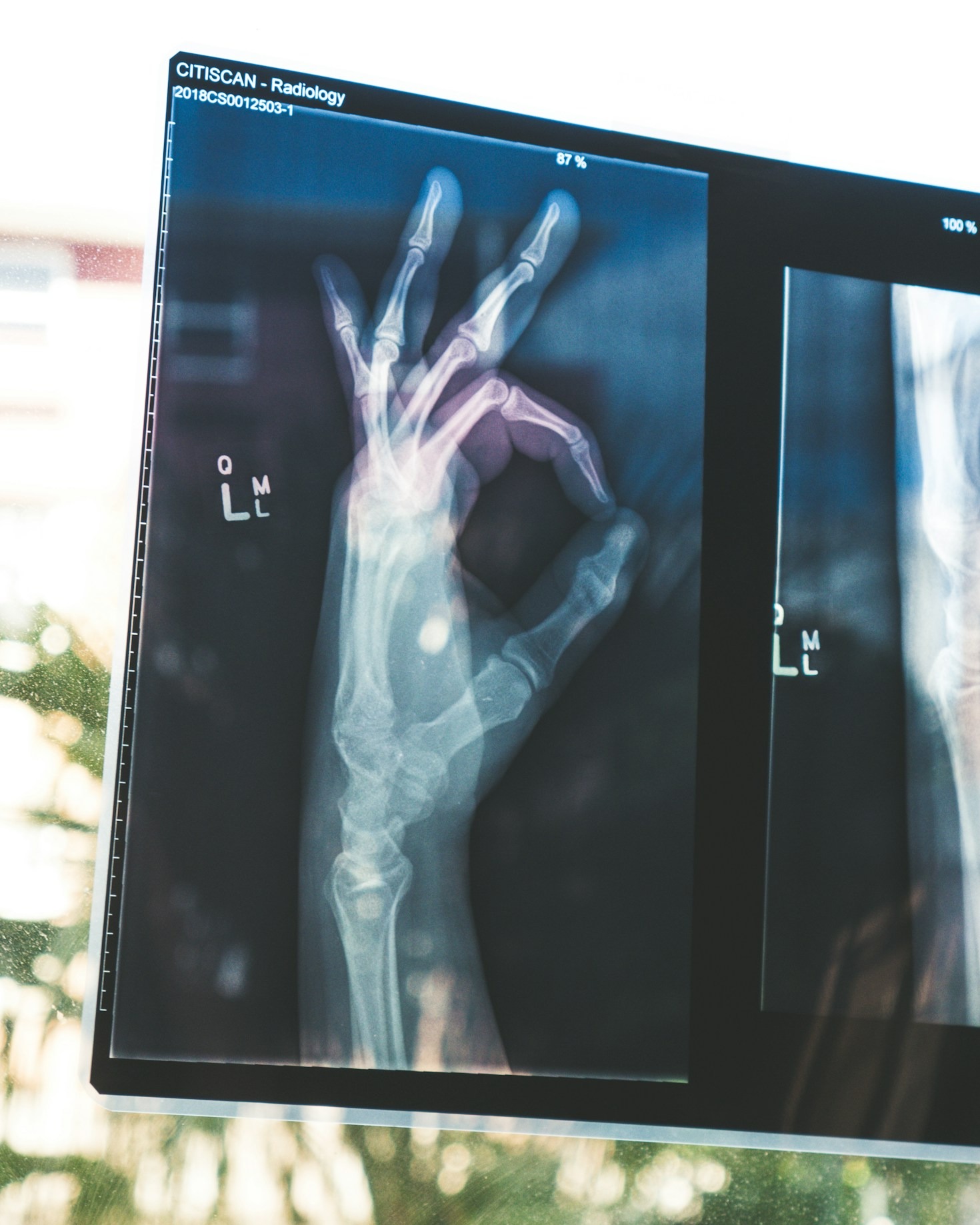 Anatomical Case Studies Every Radiologist Should Know